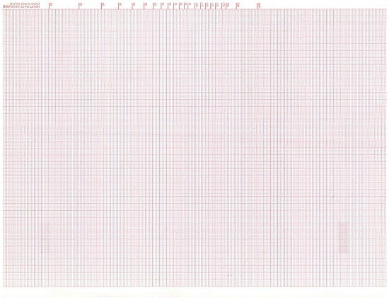 ECG Recording Paper