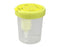 Urine Specimen Container Screw Cap 120 mL