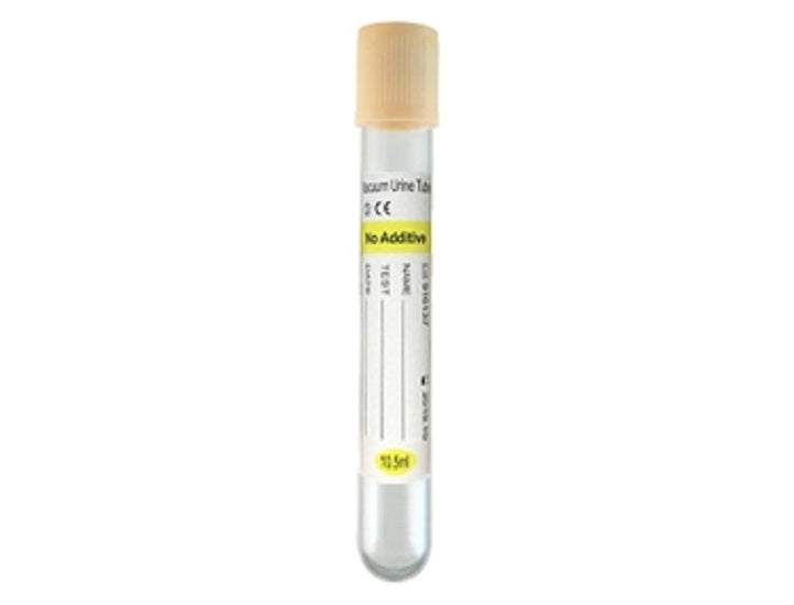 Urinalysis Tube Round Bottom Plain 16 X 100 mm 8 mL Yellow Screw Cap Plastic Tube