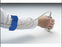Cone Instruments - Cable Brace 16.75 Inch Max Circumference For use with Sonographers - 941501