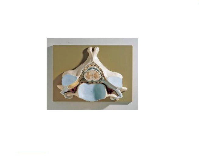 Spinal Cord Section Model