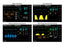 Multi-Parameter Monitor 