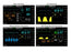740 SELECT - Patient Monitor Vital Signs Monitoring Type NIBP, SpO2 AC Power / Battery Operated - 25645