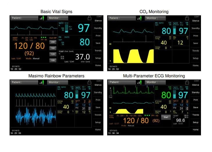 740 SELECT - Patient Monitor Vital Signs Monitoring Type NIBP, SpO2 AC Power / Battery Operated - 25645