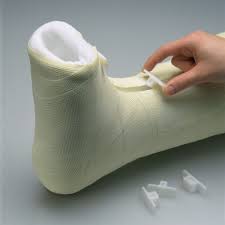 Caste Wedge