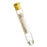 Vacutainer Specialty Tubes by BD