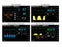 740 SELECT - Patient Monitor Vital Signs Monitoring Type NIBP, SpO2, Temperature AC Power / Battery Operated - 25647