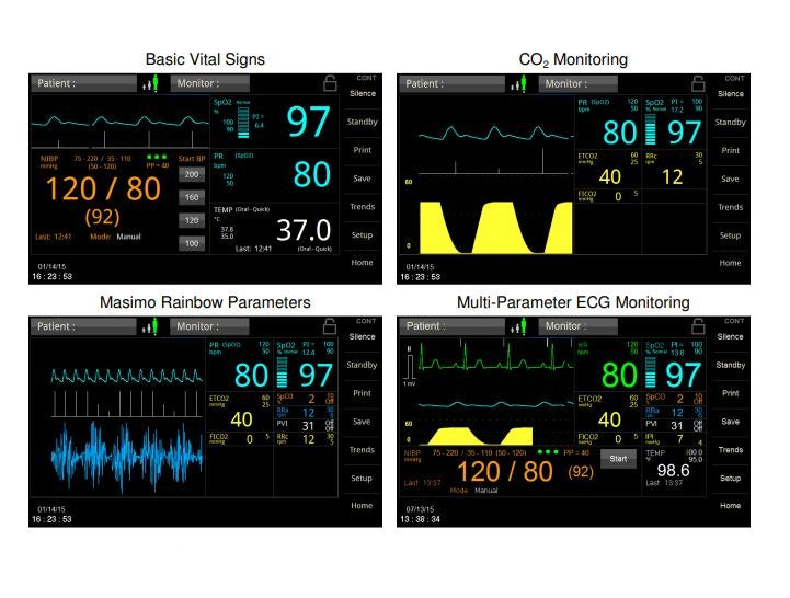 Multi-Parameter Monitor 