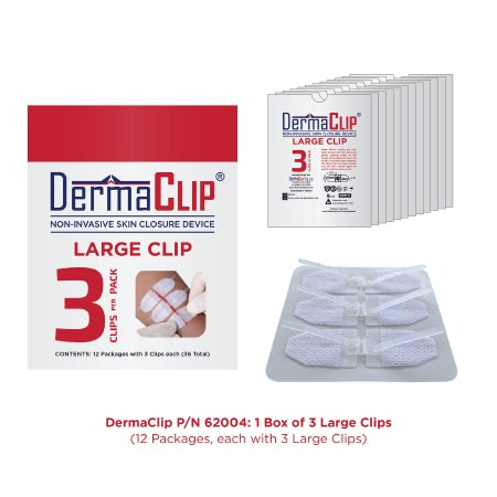DermaClip - Non-Invasive Skin Closure 3 Inch X 21MM Clear - 62004