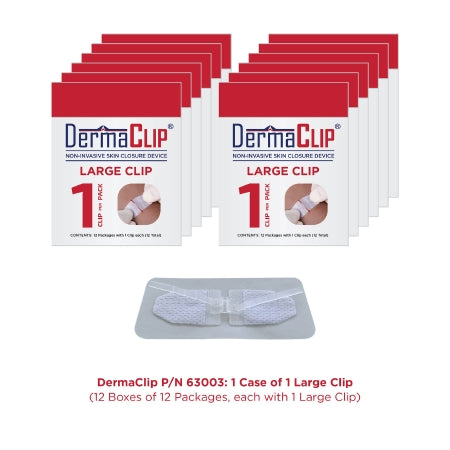 DermaClip - Non-Invasive Skin Closure 1 Inch X 21MM Clear - Dermaclip Us - 63003