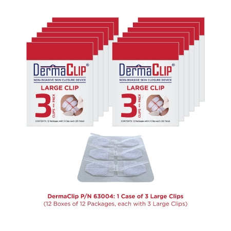 DermaClip - Non-Invasive Skin Closure 3 INch X 21MM Clear - 63004