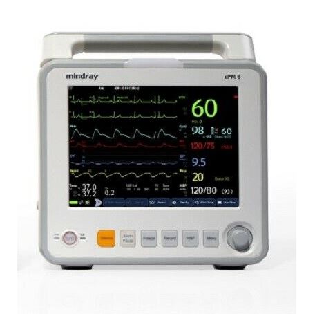 Patient Monitor