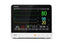 ePM 10 - Patient Monitor Monitoring ECG, NIBP, SpO2, Temperature Battery Operated - Mindray Usa - 121-001875-00