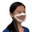 ClearMask - Surgical Mask Anti-fog Elastic Strap One Size Fits Most Clear NonSterile ASTM Level 3 Adult - CM004EZ
