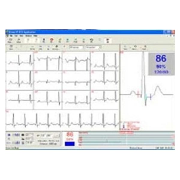 Norav Medical Software Stress Test For Norav 1200 Ea - S2