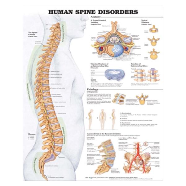 Wolters Kluwer Health Inc Chart Anatomical Vertebral Column 20X26" Ea - 9781587794438