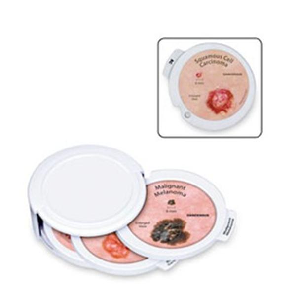 GPI Anatomical Skin Cancer Disk Set Educational Each - SB47381U