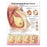 Wolters Kluwer Health Inc Chart Anatomical Understanding Breast Cancer English 20X26" Ea - 1451185645