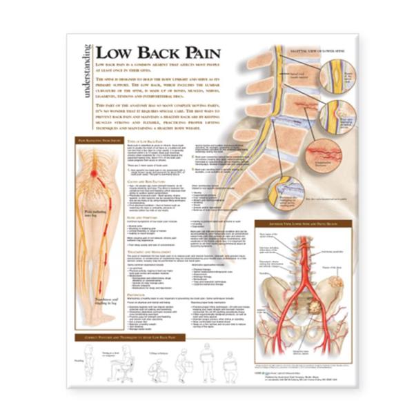 Wolters Kluwer Health Inc Chart Anatomical Understanding Low Back Pain 20X26" Ea - 9780781782432