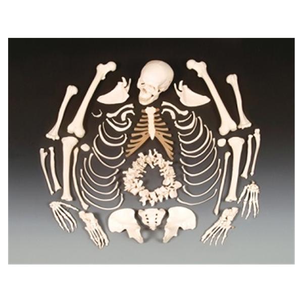 Wolters Kluwer Health Inc Disarticulated Skeleton Model Anatomical Budget Ea - CHA5/1