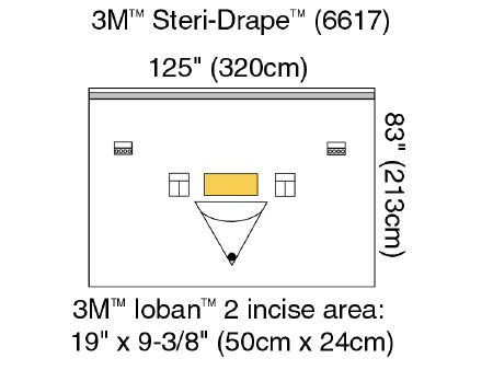 3M Steri-Drape - Orthopedic Drape Isolation Drape with Incise and Pouch 125 W X 83 L Inch Sterile - 6617