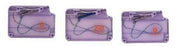 J & J Healthcare Systems Suture Assistant with Ethibond Excel Suture Loading Unit EEN (Canoe) Needle Nonabsorbable Braided Polyester Green Size 2-0 - SW112