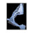 Preferred Medical Systems Drape C-Arm 36X90" 20/Ca - C-ARM 90B