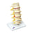 Fabrication Enterprises Vertebrae Degeneration Model Anatomical Stages Of Prolapsed Disc Ea - 965307