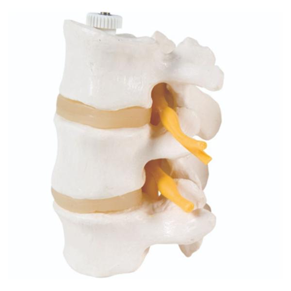 Fabrication Enterprises 3 Lumbar Vertebrae Model Anatomical Ea - 985031
