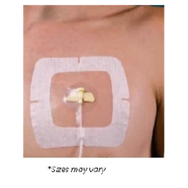 Centurion Medical Products Dressing Iv Secureview Port Film 5-1/2X6-1/2" Adhesive Non-Adherent 50/Case - SCP66VXT