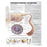 Wolters Kluwer Health Inc Chart Educational Understanding Diabetes 20X26" Ea - 9781469894898