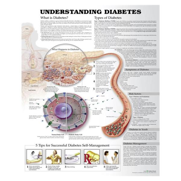 Wolters Kluwer Health Inc Chart Educational Understanding Diabetes Ea - 9781469894928