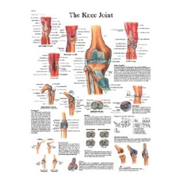 Fabrication Enterprises Chart Knee Joint 20X25" Ea - 12-4611L