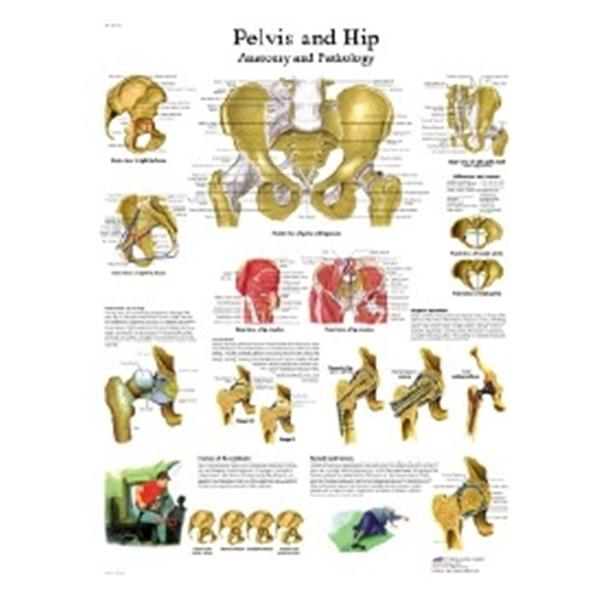 Fabrication Enterprises Chart Hip And Pelvis 20X25" Ea - 12-4617L