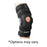 Breg. Brace Road Runner Knee Airmesh Black Size 2X-Large Ea - 14156