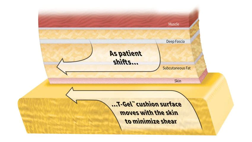 AliMed T-Gel Plus Bariatric - Bariatric Seat Cushion 20 W X 18 X 1-5/8 D Inch Foam / Gel - 10877