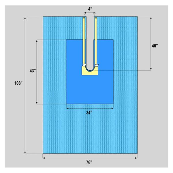 Welmed Inc Drape Sheet 76X108" Blue Sterile 18/Ca - 1222-1940