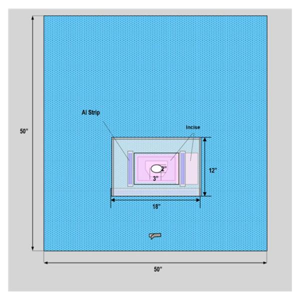 Welmed Inc Drape Sheet 50X50" Blue Sterile 30/Ca - 1222-9502