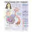 Wolters Kluwer Health Inc Chart Anatomical Understanding Type 1 Diabetes 20X26" Ea - 9781469894935