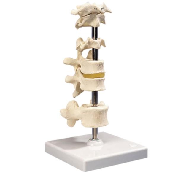 Fabrication Enterprises Vertebra Column Model 6-Part Ea - 983935