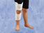 Deroyal Knee Immobilizer Stat Pediatric Large Hook And Loop Closure 8 To 14 Inch Circumference 8 Inch Length Left Or Right Knee - 7064-03