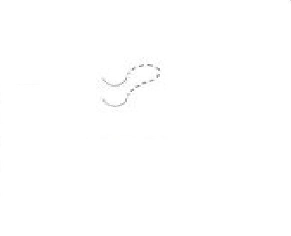 Circle Side Cutting Lancet Needle