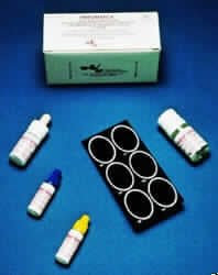 Alere Rheumatex Rapid Test Kit Latex Agglutination Test Rheumatoid Factor Serum Sample Non-CLIA Waived 100 Tests - 34S2