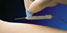 BD Vacutainer Safety-Lok - Blood Collection Set 23 Gauge 3/4 Inch Needle Length Safety Needle 12 Inch Tubing Sterile - 02664
