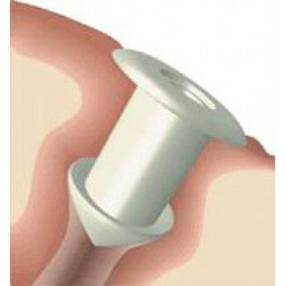 Soft Plug Silicone Plug 0.5mm Mini