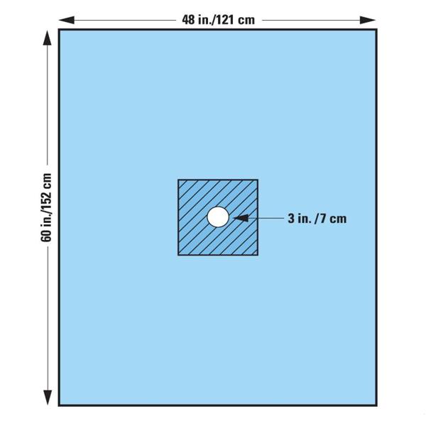 O & M Halyard Drape Minor Procedure 3" Fenestrated 48X60" Blue Sterile 40/Ca - 89207