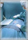Koslin - Orthopedic Drape TMJ Bi-Lateral Drape Body Drape: 77 X 78 Inch, Head Drapes: 77 X 55-1/2 Inch - 3983