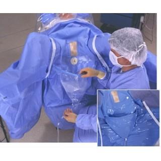 Microtek Medical - Abdominal Drape Endoscopy / Lingeman Lithotomy Drape - 14-11173