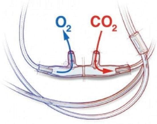 Salter Labs CANNULA, NASAL W/14' O2 LINE/CO2 LINE W/ML LL CONN (25/CS) - 49SOFT-14-14-25