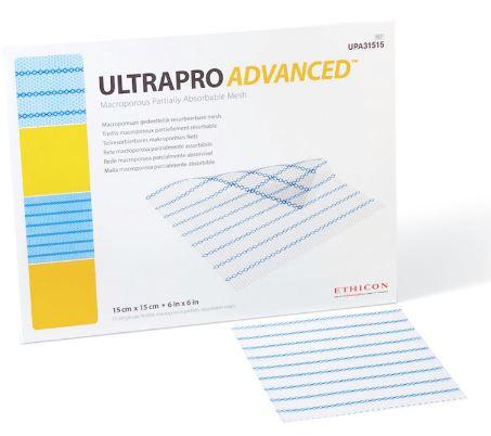 J & J Healthcare Systems ULTRAPRO ADVANCED Hernia Repair Mesh Partially Absorbable Polypropylene / Poliglecaprone-25 15 cm x 15 cm Square Style - UPA31515